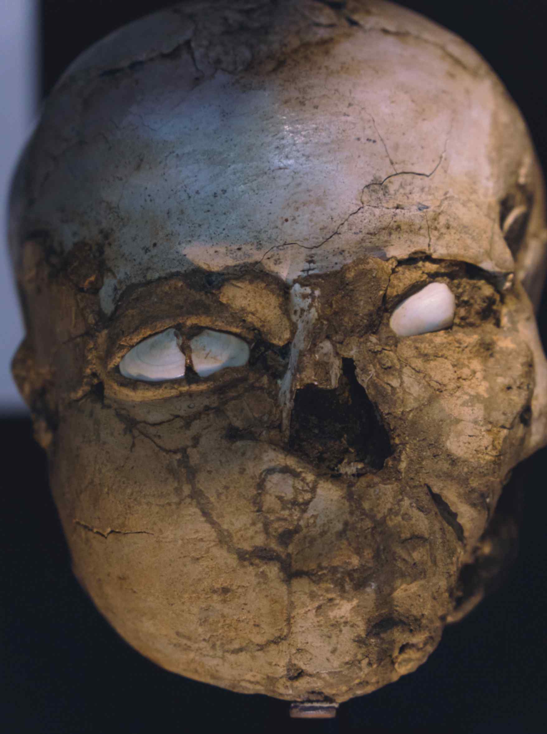 Deformed Skull